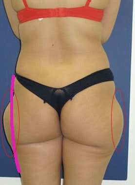 Love handles and online saddlebags